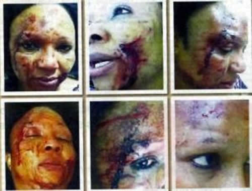 Ambassador Wigwe Assaults Wife, Tess Wigwe